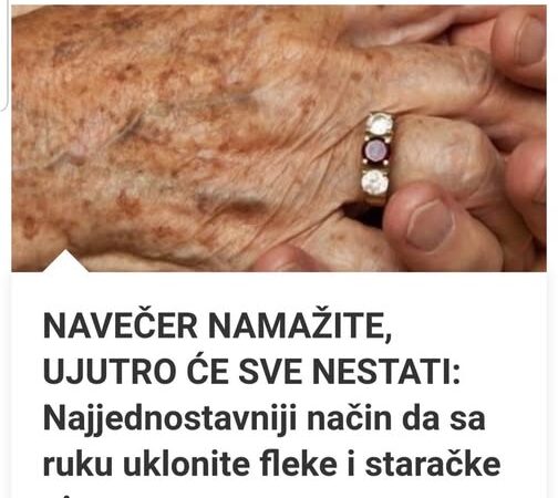 NAVEČER NAMAŽITE, UJUTRO ĆE SVE NESTATI: Najjednostavniji način da sa ruku uklonite fleke i staračke pjege