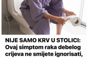 NIJE SAMO KRV U STOLICI: Ovaj simptom raka debelog crijeva ne smijete ignorisati, a najčešće ne može da se prepozna