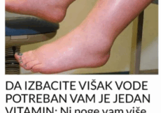 Potreban vam je JEDAN vitamin da biste se riješili viška vode: noge vam više neće oticati, samo ga uključite u prehranu