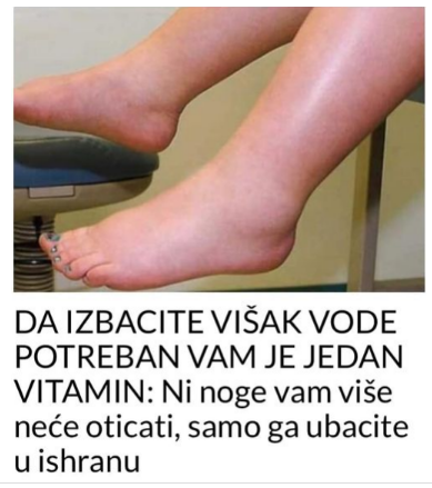 Potreban vam je JEDAN vitamin da biste se riješili viška vode: noge vam više neće oticati, samo ga uključite u prehranu