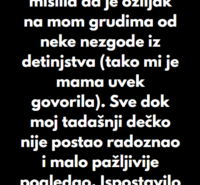 “Punih 21 godinu sam mislila da je ožiljak na mom grudima od neke nezgode iz detinjstva…”