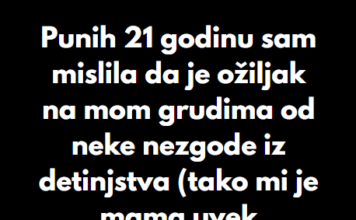 “Punih 21 godinu sam mislila da je ožiljak na mom grudima od neke nezgode iz detinjstva…” “Punih 21 godinu sam mislila da je ožiljak na mom grudima od neke nezgode iz detinjstva…”