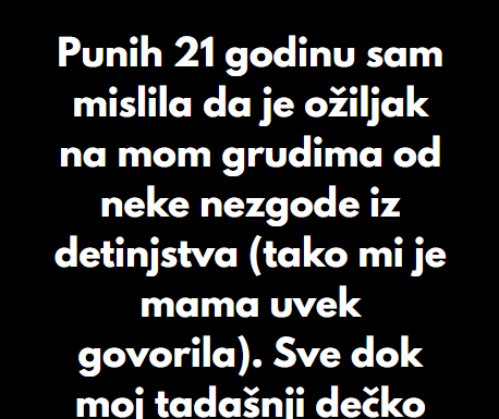 “Punih 21 godinu sam mislila da je ožiljak na mom grudima od neke nezgode iz detinjstva…” “Punih 21 godinu sam mislila da je ožiljak na mom grudima od neke nezgode iz detinjstva…”