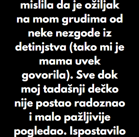 “Punih 21 godinu sam mislila da je ožiljak na mom grudima od neke nezgode iz detinjstva…”
