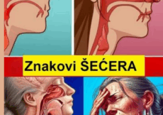 Skriveni znakovi šećera u krvi: Ne ignorišite OVE simptome!