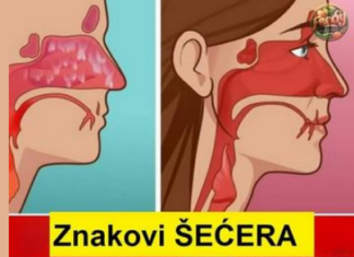 Skriveni znakovi šećera u krvi: Ne ignorišite OVE simptome! Skriveni znakovi šećera u krvi: Ne ignorišite OVE simptome!