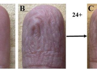 Sledeći put kad vam se jagodice prstiju SMEŽURAJU od vode, dobro ih pogledajte – ovo sigurno NISTE do sad zapazili! Sledeći put kad vam se jagodice prstiju SMEŽURAJU od vode, dobro ih pogledajte – ovo sigurno NISTE do sad zapazili!