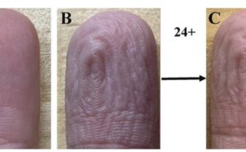 Sledeći put kad vam se jagodice prstiju SMEŽURAJU od vode, dobro ih pogledajte – ovo sigurno NISTE do sad zapazili! Sledeći put kad vam se jagodice prstiju SMEŽURAJU od vode, dobro ih pogledajte – ovo sigurno NISTE do sad zapazili!