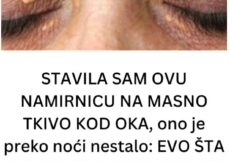 STAVILA SAM OVU NAMIRNICU NA MASNO TKIVO KOD OKA, ono je preko noći nestalo: EVO ŠTA ME SPASILO, SVI GA IMATE U KUĆI