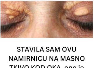 STAVILA SAM OVU NAMIRNICU NA MASNO TKIVO KOD OKA, ono je preko noći nestalo: EVO ŠTA ME SPASILO, SVI GA IMATE U KUĆI STAVILA SAM OVU NAMIRNICU NA MASNO TKIVO KOD OKA, ono je preko noći nestalo: EVO ŠTA ME SPASILO, SVI GA IMATE U KUĆI