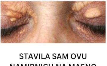 STAVILA SAM OVU NAMIRNICU NA MASNO TKIVO KOD OKA, ono je preko noći nestalo: EVO ŠTA ME SPASILO, SVI GA IMATE U KUĆI STAVILA SAM OVU NAMIRNICU NA MASNO TKIVO KOD OKA, ono je preko noći nestalo: EVO ŠTA ME SPASILO, SVI GA IMATE U KUĆI