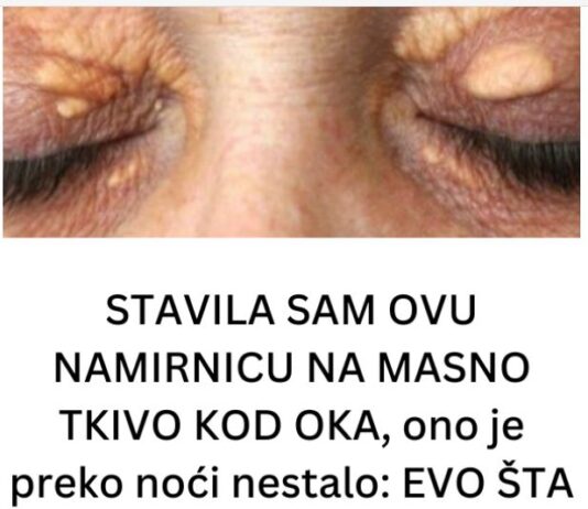 STAVILA SAM OVU NAMIRNICU NA MASNO TKIVO KOD OKA, ono je preko noći nestalo: EVO ŠTA ME SPASILO, SVI GA IMATE U KUĆI STAVILA SAM OVU NAMIRNICU NA MASNO TKIVO KOD OKA, ono je preko noći nestalo: EVO ŠTA ME SPASILO, SVI GA IMATE U KUĆI