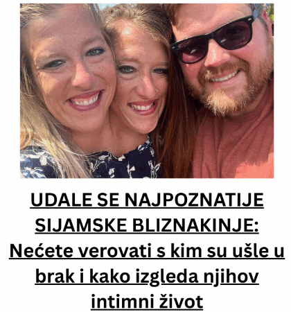 UDALE SE NAJPOZNATIJE SIJAMSKE BLIZNAKINJE: Nećete verovati s kim su ušle u brak i kako izgleda njihov intimni život