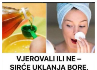 VJEROVALI ILI NE – SIRĆE VAM MOŽE POMOĆI DA SE RIJEŠITE BORA, AKNI I STARAČKIH PJEGA VJEROVALI ILI NE – SIRĆE VAM MOŽE POMOĆI DA SE RIJEŠITE BORA, AKNI I STARAČKIH PJEGA