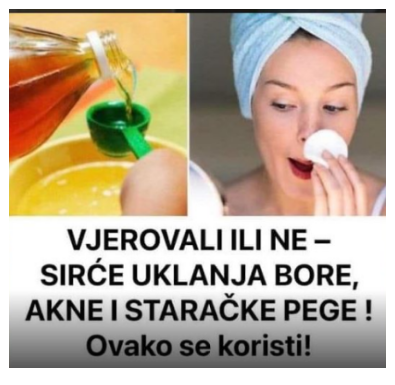 VJEROVALI ILI NE – SIRĆE VAM MOŽE POMOĆI DA SE RIJEŠITE BORA, AKNI I STARAČKIH PJEGA