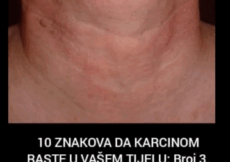 10 ZNAKOVA DA KARCINOM RASTE U VAŠEM TIJELU: Broj 3. svi zanemaruju, a to je znak za uzbunu! 10 ZNAKOVA DA KARCINOM RASTE U VAŠEM TIJELU: Broj 3. svi zanemaruju, a to je znak za uzbunu!