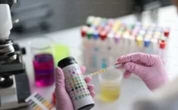 Ako vam je urin bez boje, možda je ugrožena funkcija srca i mozga Ako vam je urin bez boje, možda je ugrožena funkcija srca i mozga