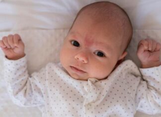 Beba ima hematom nakon poroda: Trebate li se zabrinuti? Beba ima hematom nakon poroda: Trebate li se zabrinuti?
