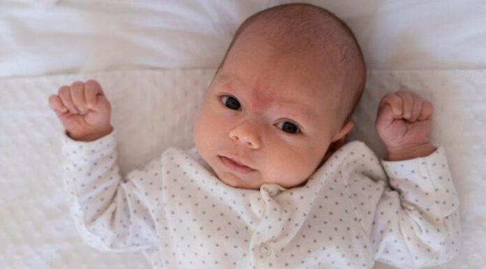 Beba ima hematom nakon poroda: Trebate li se zabrinuti? Beba ima hematom nakon poroda: Trebate li se zabrinuti?