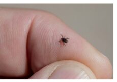 Bezbolno je i nema čupanja: Doktorka otkrila trik kako da se krpelj sam otkači sa kože (video)