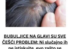 BUBULJICE NA GLAVI SU SVE ČEŠĆI PROBLEM: Ni slučajno ih ne istiskujte, evo zašto se javljaju I ŠTA TREBATE URADITI DA NESTANU