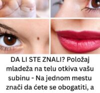 DA LI STE ZNALI Položaj mladeža na telu otkiva vašu subinu – Na jednom mestu znači da ćete se obogatiti, a ako je na nosu i prstima, ne valja nikako