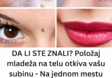 DA LI STE ZNALI Položaj mladeža na telu otkiva vašu subinu – Na jednom mestu znači da ćete se obogatiti, a ako je na nosu i prstima, ne valja nikako