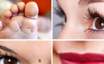 DA LI STE ZNALI Položaj mladeža na telu otkiva vašu subinu – Na jednom mestu znači da ćete se obogatiti, a ako je na nosu i prstima, ne valja nikako DA LI STE ZNALI Položaj mladeža na telu otkiva vašu subinu – Na jednom mestu znači da ćete se obogatiti, a ako je na nosu i prstima, ne valja nikako