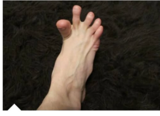 DA LI VAM SE GRČE PRSTI NA STOPALIMA? Evo na šta vas to upozorava, može biti znak većih problema DA LI VAM SE GRČE PRSTI NA STOPALIMA? Evo na šta vas to upozorava, može biti znak većih problema