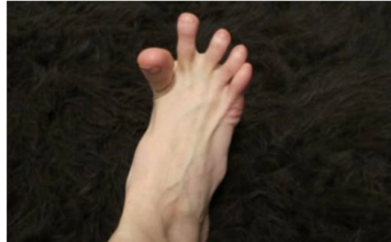 DA LI VAM SE GRČE PRSTI NA STOPALIMA? Evo na šta vas to upozorava, može biti znak većih problema DA LI VAM SE GRČE PRSTI NA STOPALIMA? Evo na šta vas to upozorava, može biti znak većih problema