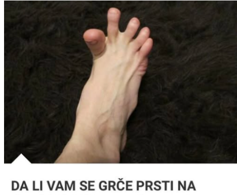 DA LI VAM SE GRČE PRSTI NA STOPALIMA? Evo na šta vas to upozorava, može biti znak većih problema DA LI VAM SE GRČE PRSTI NA STOPALIMA? Evo na šta vas to upozorava, može biti znak većih problema
