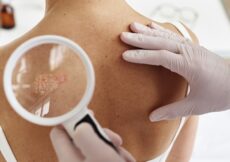 Dr. Sanja Umičević Šipka: "Biološka terapija dostupna i u BiH – novi pomak u liječenju psorijaze"
