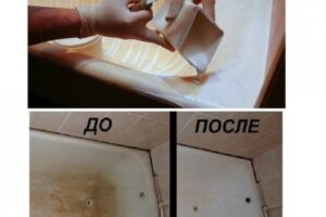 KADA VAM JE ŽUTA OD KAMENCA A NASLAGE SE KONSTANTNO VRAĆAJU: Ovaj trik je spas, NAMAŽITE KADU OVOM DOMAĆOM SMJESOM