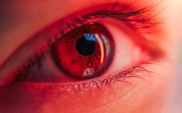 Ne zanemarujte crvenilo očiju nakon bazena – može biti ozbiljno! Ne zanemarujte crvenilo očiju nakon bazena – može biti ozbiljno!