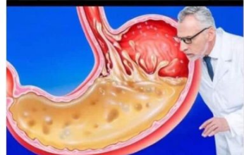 OVO JEDITE ZA VEČERU 3 DANA ZAREDOM: Nećete vjerovati šta će izaći iz vašeg stomaka OVO JEDITE ZA VEČERU 3 DANA ZAREDOM: Nećete vjerovati šta će izaći iz vašeg stomaka