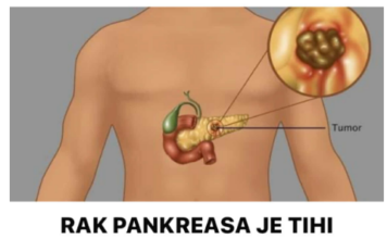 RAK PANKREASA JE TIHI UBICA. Stručnjaci upozoravaju da obratite pažnju na pet glavnih simptoma RAK PANKREASA JE TIHI UBICA. Stručnjaci upozoravaju da obratite pažnju na pet glavnih simptoma