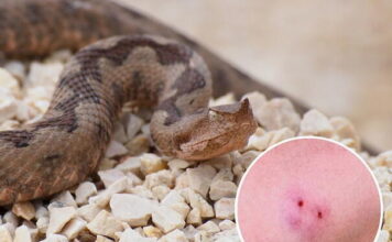 Ugriz zmije u BiH: Znate li kako pružiti prvu pomoć i šta nikako ne smijete raditi? Ugriz zmije u BiH: Znate li kako pružiti prvu pomoć i šta nikako ne smijete raditi?
