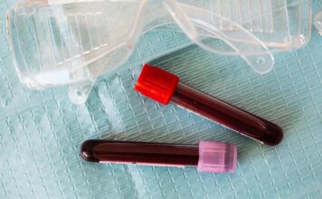 Ugrušak u tijelu? Test koji ga odmah razotkriva Ugrušak u tijelu? Test koji ga odmah razotkriva