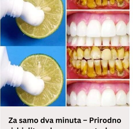 Za samo dva minuta – Prirodno izbjelite zube ovom metodom