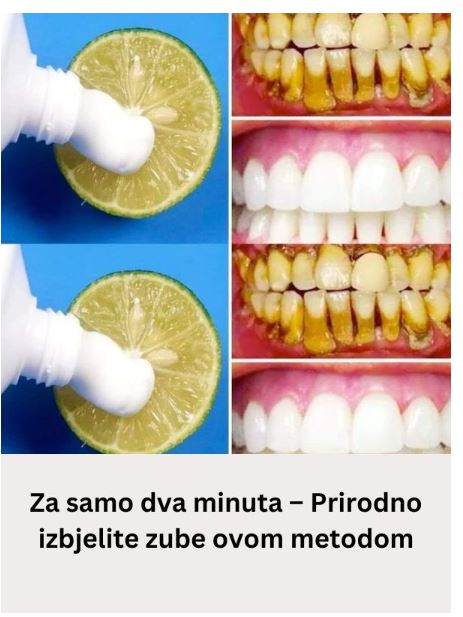 Za samo dva minuta – Prirodno izbjelite zube ovom metodom