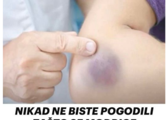 Zašto se modrice pojavljuju bez vidljivog uzroka Evo šta stručnjaci kažu Zašto se modrice pojavljuju bez vidljivog uzroka Evo šta stručnjaci kažu