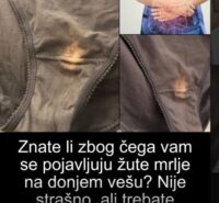 Znate li zbog čega vam se pojavljuju žute mrlje na donjem vešu. Ovo morate da znate!