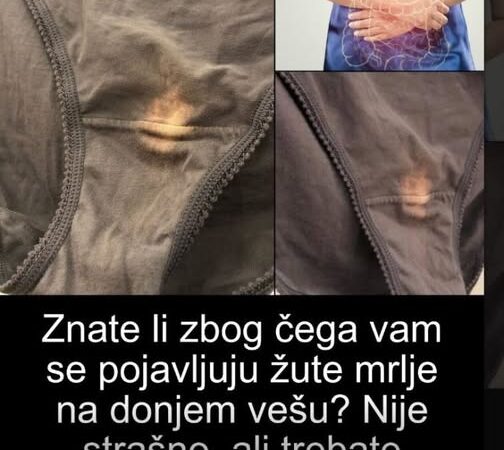 Znate li zbog čega vam se pojavljuju žute mrlje na donjem vešu. Ovo morate da znate!