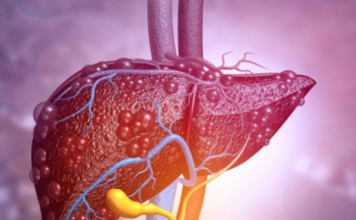 3 napitka koja pomažu da se jetra očisti od okorele masnoće dok spavamo: Za najbolje rezultate doktori preporučuju da se konzumiramo u tačno ovo vreme 3 napitka koja pomažu da se jetra očisti od okorele masnoće dok spavamo: Za najbolje rezultate doktori preporučuju da se konzumiramo u tačno ovo vreme