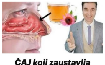 ČAJ koji zaustavlja ALERGIJE! Uklanja curenje iz nosa, svrbež očiju, kašalj ČAJ koji zaustavlja ALERGIJE! Uklanja curenje iz nosa, svrbež očiju, kašalj