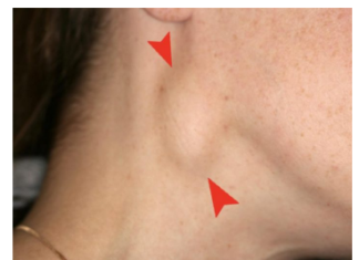 MALIGNE BOLESTI NIKADA NE ĆUTE: Ove signale bolest šalje telu, kada se u njemu razvijaju NAJOPASNIJI KARCINOMI! MALIGNE BOLESTI NIKADA NE ĆUTE: Ove signale bolest šalje telu, kada se u njemu razvijaju NAJOPASNIJI KARCINOMI!