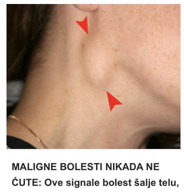 MALIGNE BOLESTI NIKADA NE ĆUTE: Ove signale bolest šalje telu, kada se u njemu razvijaju NAJOPASNIJI KARCINOMI! MALIGNE BOLESTI NIKADA NE ĆUTE: Ove signale bolest šalje telu, kada se u njemu razvijaju NAJOPASNIJI KARCINOMI!