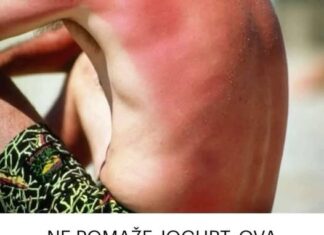 NE POMAŽE JOGURT, OVA MAJKA JE OTKRILA TRIK GODINE: Na ovaj način opekotine od sunca će nestati za POLA SATA NE POMAŽE JOGURT, OVA MAJKA JE OTKRILA TRIK GODINE: Na ovaj način opekotine od sunca će nestati za POLA SATA