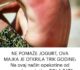 NE POMAŽE JOGURT, OVA MAJKA JE OTKRILA TRIK GODINE: Na ovaj način opekotine od sunca će nestati za POLA SATA