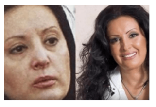 “Ni ona sada nije odolila trendu vjecne mladosti: Draga Dragana sto ti je ovo trebalo- izoblicila se, vise ne lici na sebe?” “Ni ona sada nije odolila trendu vjecne mladosti: Draga Dragana sto ti je ovo trebalo- izoblicila se, vise ne lici na sebe?”